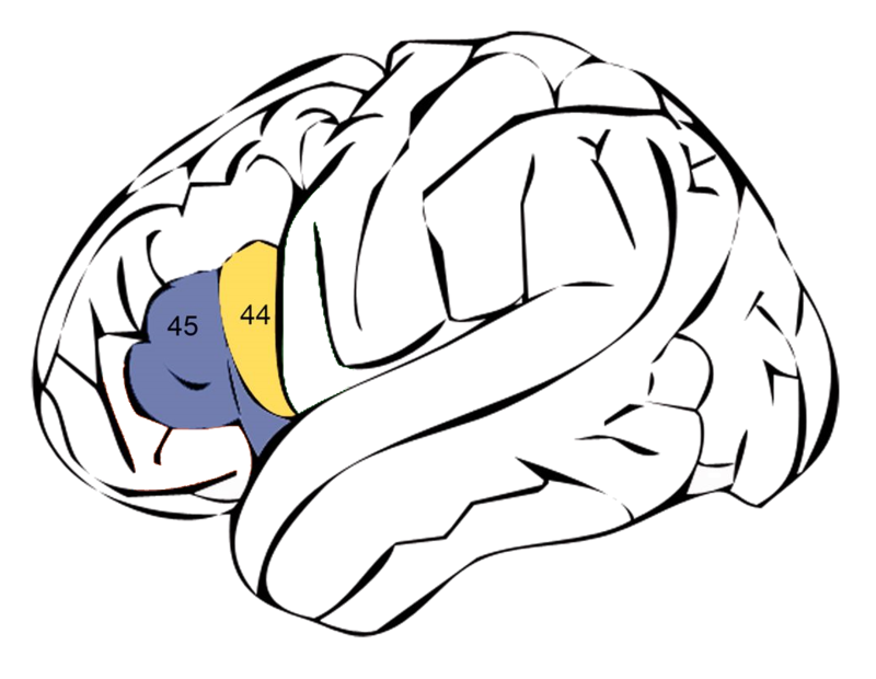 Afasia De Broca Principales Caracter Sticas Neuroaid