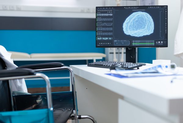 Trombectomía mecánica