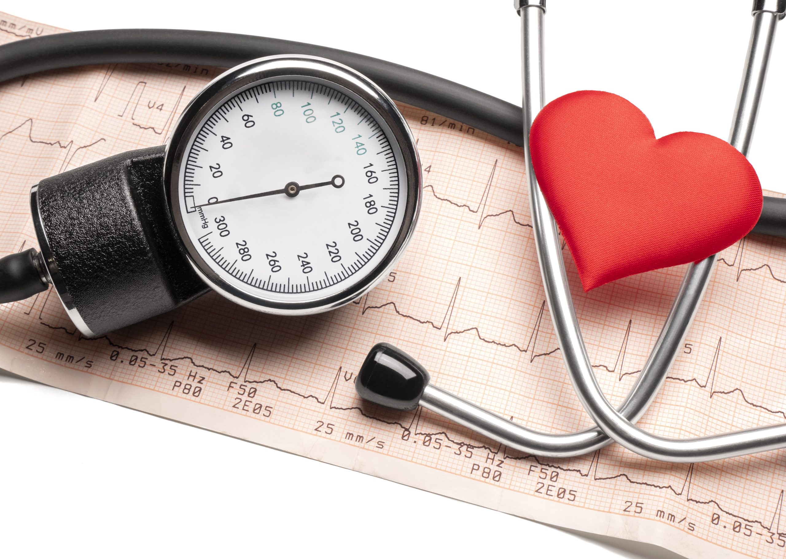 Cómo la hipertensión arterial aumenta el riesgo de ACV
