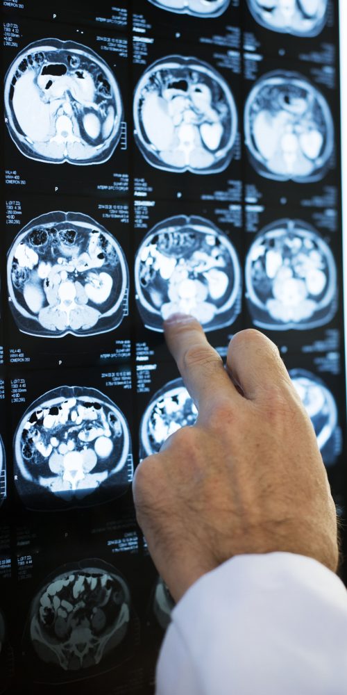 brain ct scan x ray film 2021 09 04 15 57 12 utc min