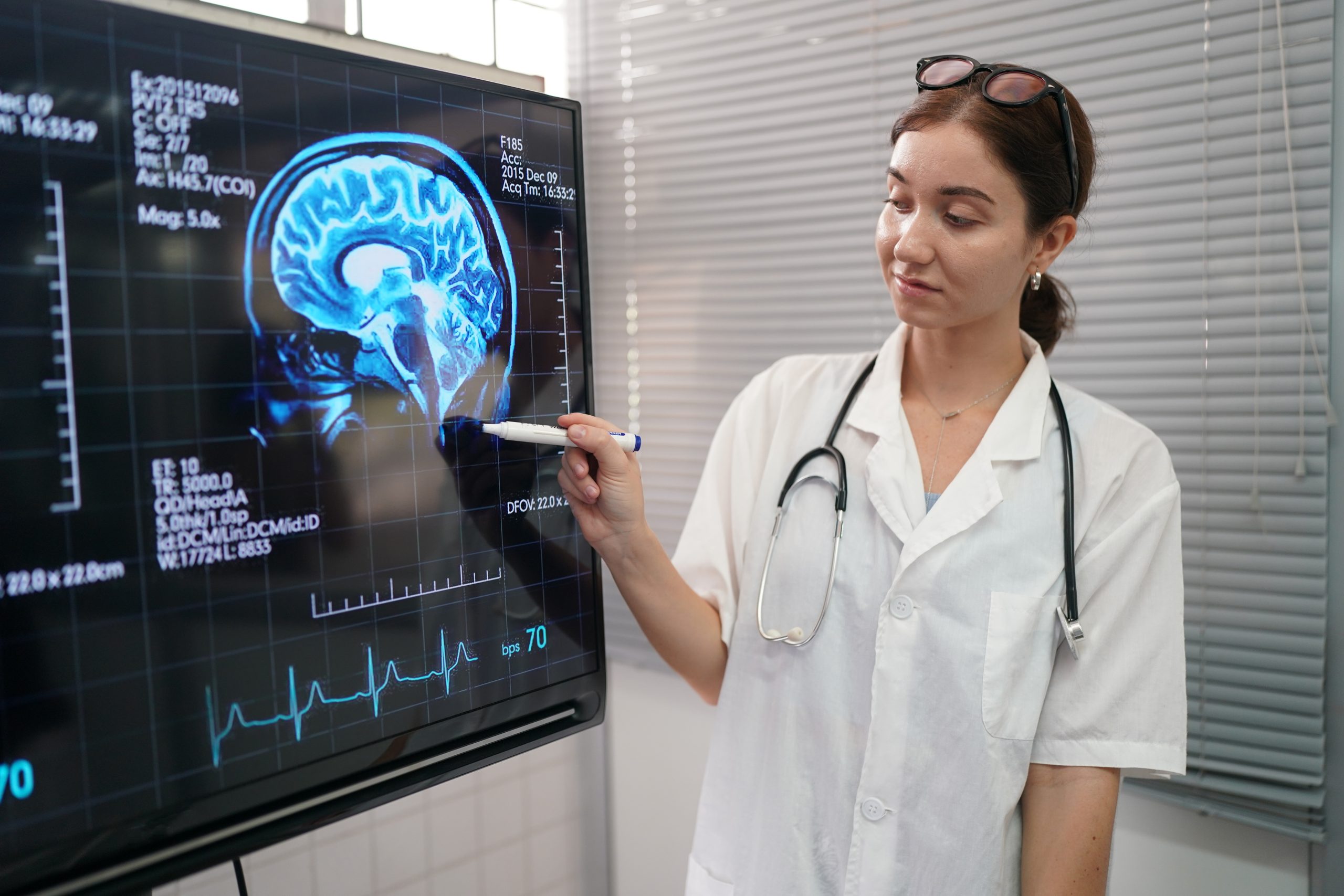 Moyamoya Esperanza Y Avances En La Lucha Cerebral NeuroAiD 