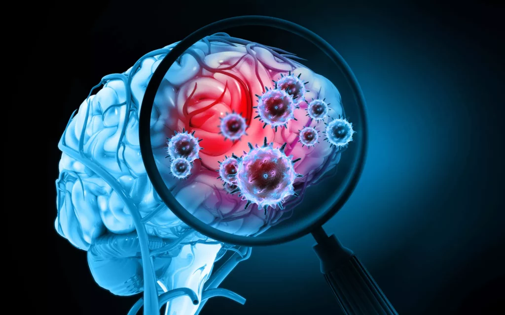Meningite fúngica: estratégias com antifúngicos e manejo clínico 3 Meningite fúngica