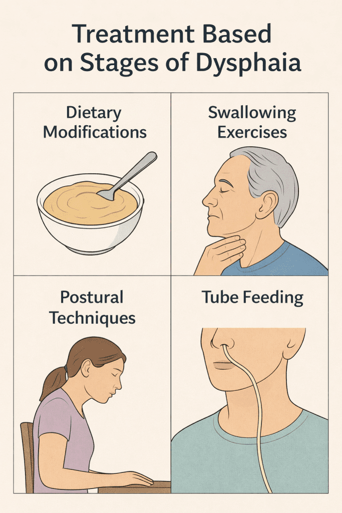 stages of dysphagia