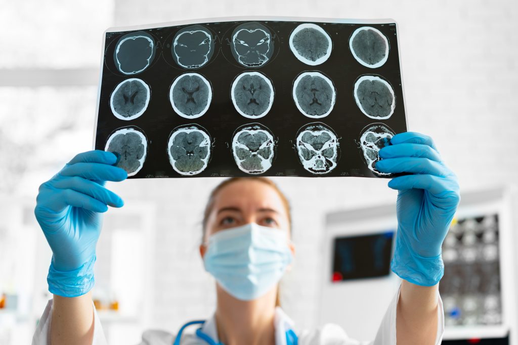 Arteria cerebral media
