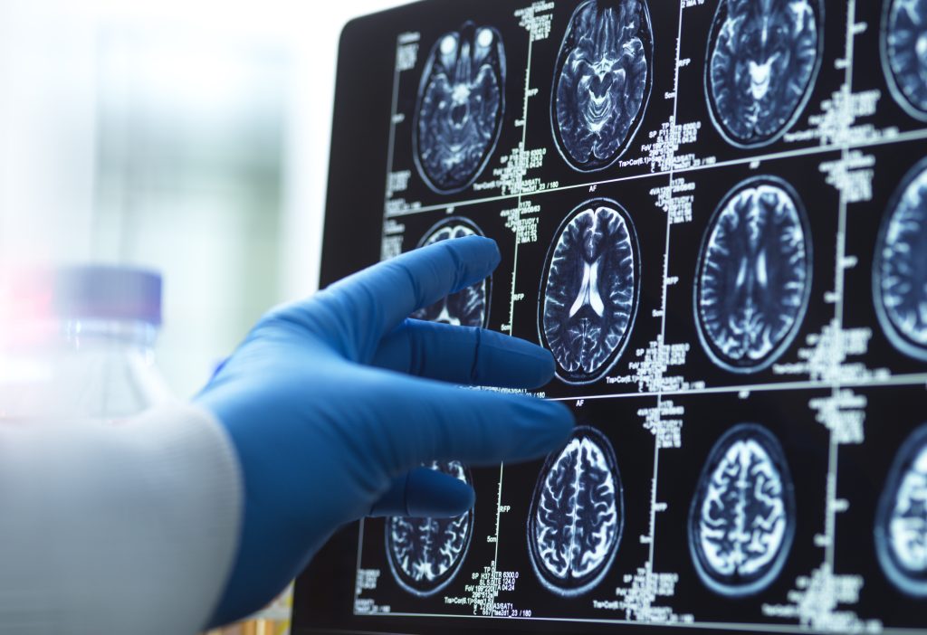 Corteza somatosensorial: funciones y qué ocurre cuando se lesiona 2 Corteza somatosensorial