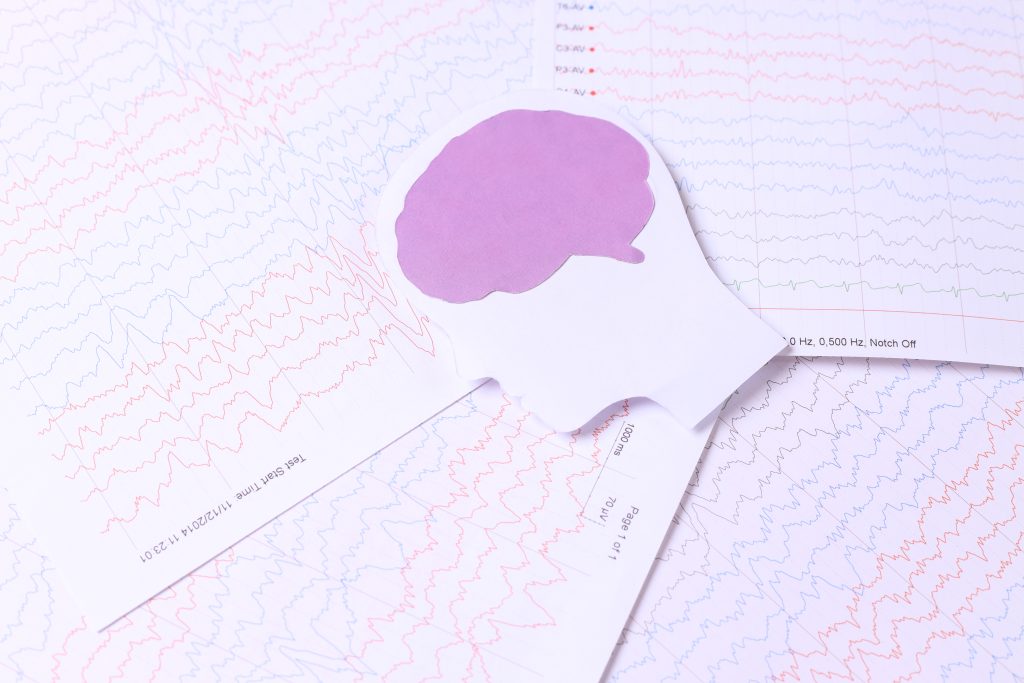 How Long Does Aphasia Last?: Understanding Language Recovery 1 Aphasia Last