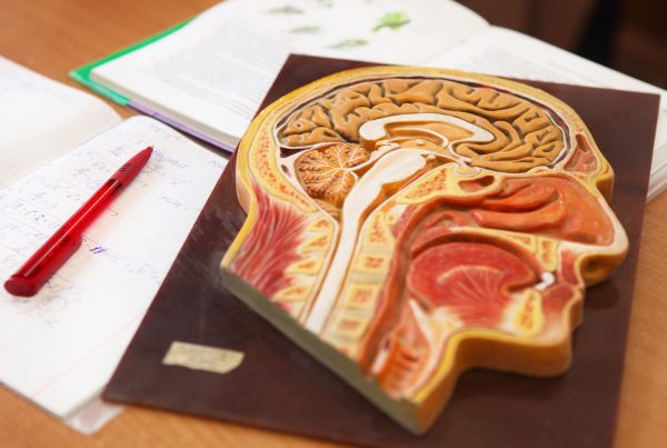 Disección de la arteria vertebral: una causa de ictus poco conocida 9 Disección de la arteria vertebral