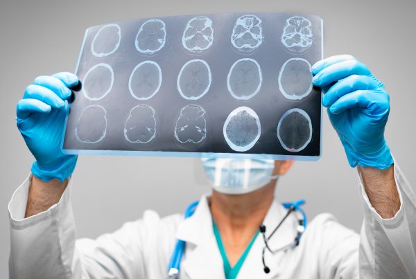 Fases del ACV y su impacto 5 Fases del ACV