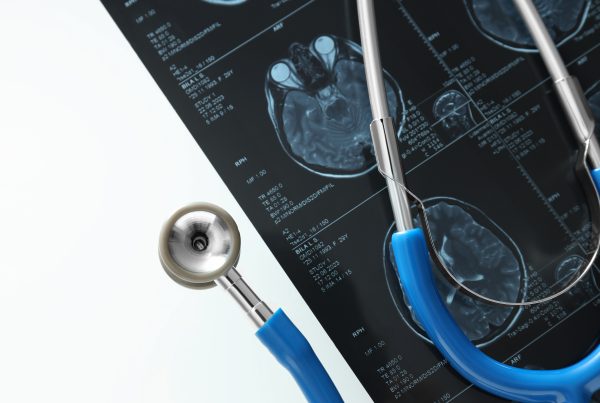 Infarto talámico: cuando el tálamo deja de comunicar 4 Infarto talámico