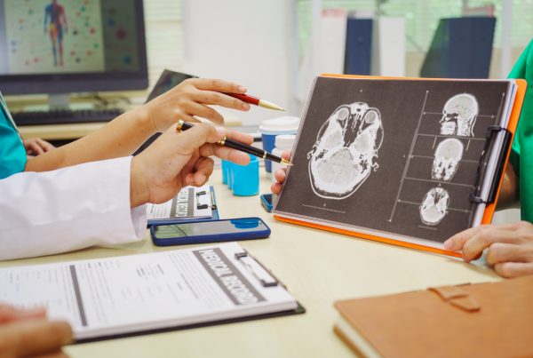La ínsula cerebral: el infarto que puede pasar desapercibido 10 La ínsula cerebral