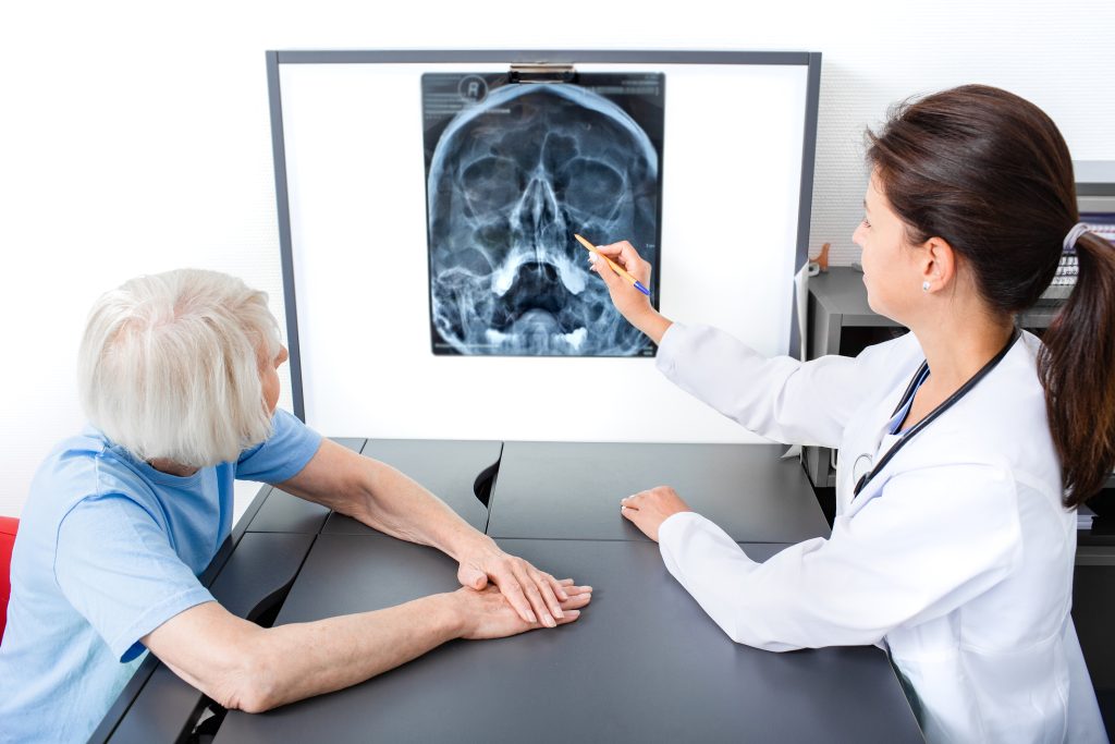 Pronóstico después de un accidente cerebrovascular 2 Pronóstico después de un accidente cerebrovascular