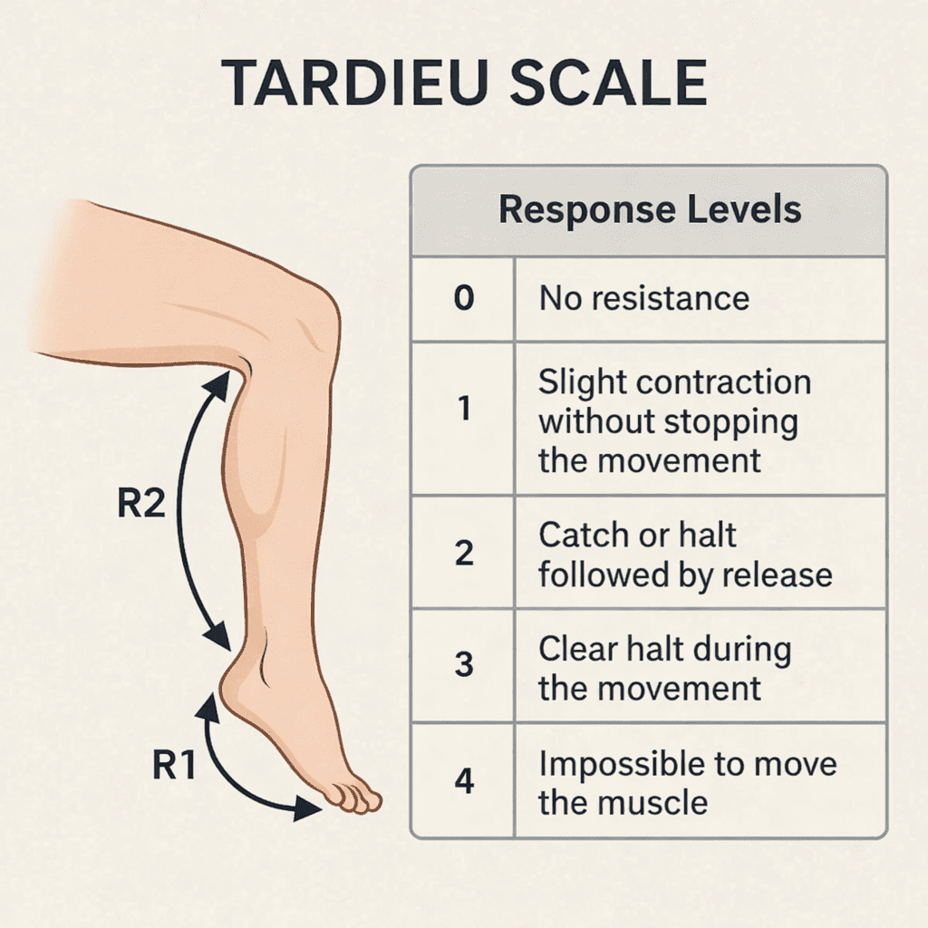 Tardieu scale