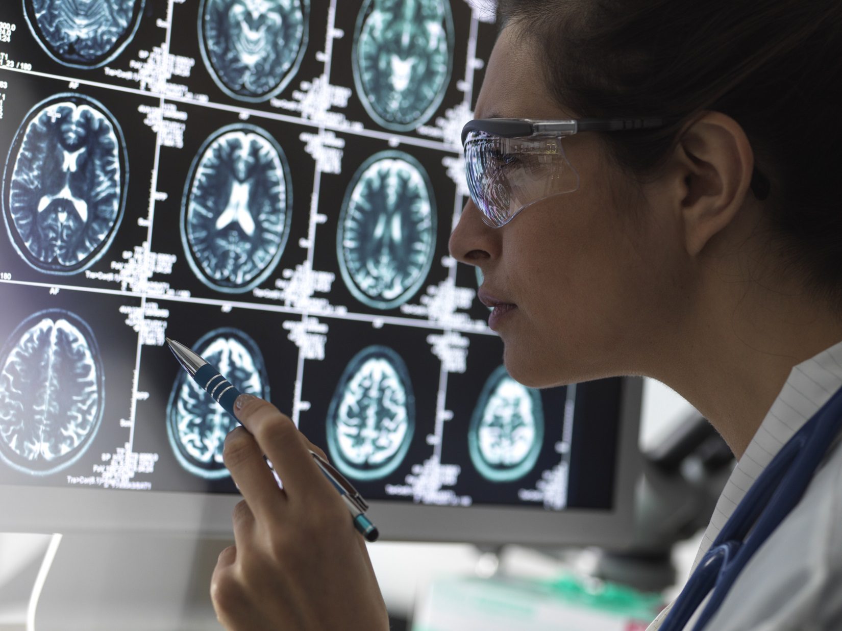 Necrose neuronal excitotóxica