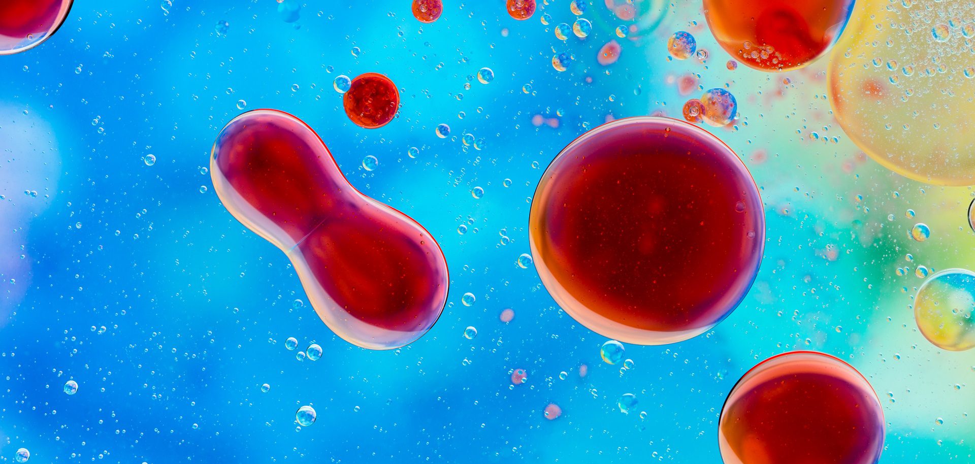 Plasma homocysteine: a key biomarker in brain health 2 Plasma homocysteine