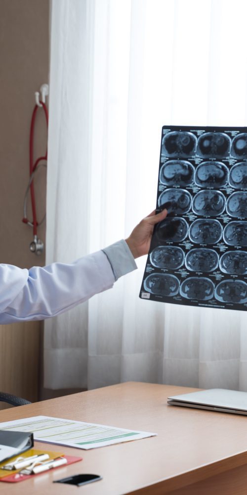 asian doctor holding x ray radiography to patient 2021 10 21 03 07 28 utc min