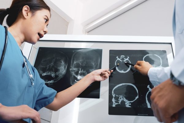 Cómo saber si voy a sufrir un infarto cerebral: señales 8 to have a stroke