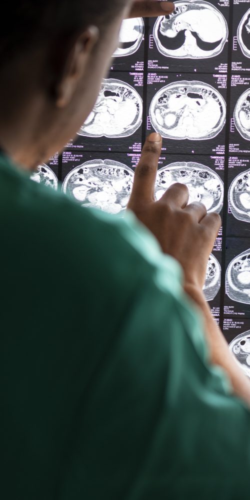 doctor reading brain mri x ray result 2022 01 06 02 39 24 utc min