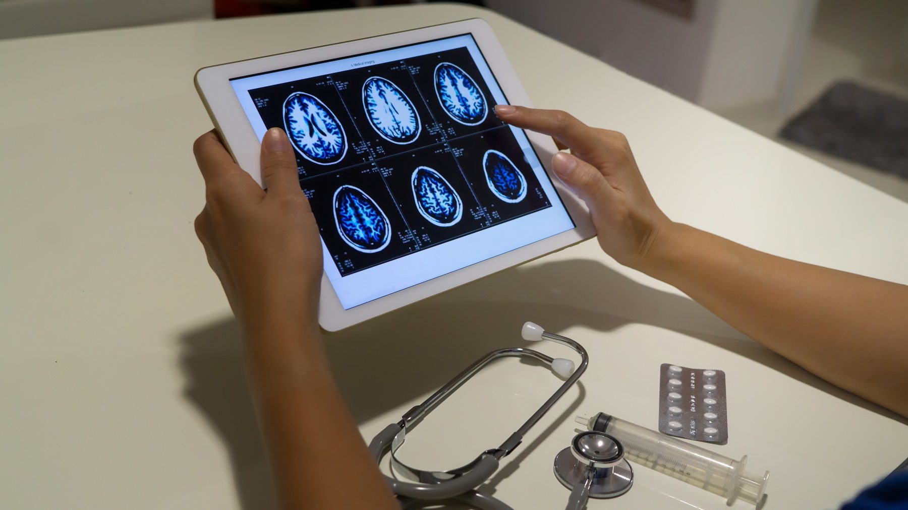 barreira hematoencefálica