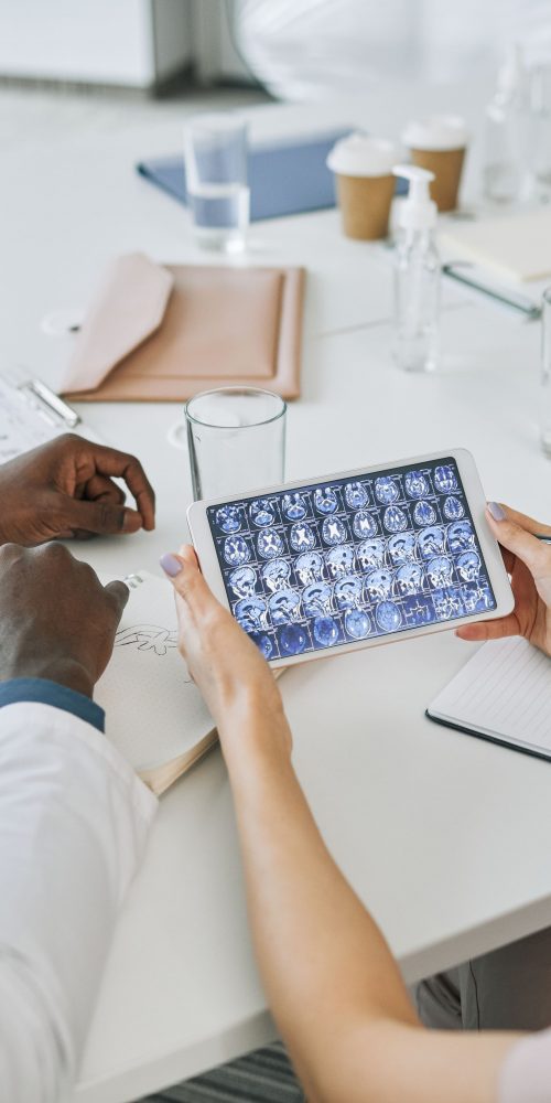 doctors looking at brain mri 2021 09 24 04 19 19 utc min