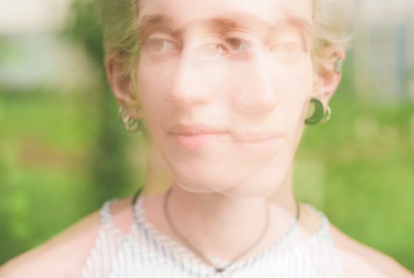 Diplopia: Una visión doble que requiere atención médica 10 Diplopia