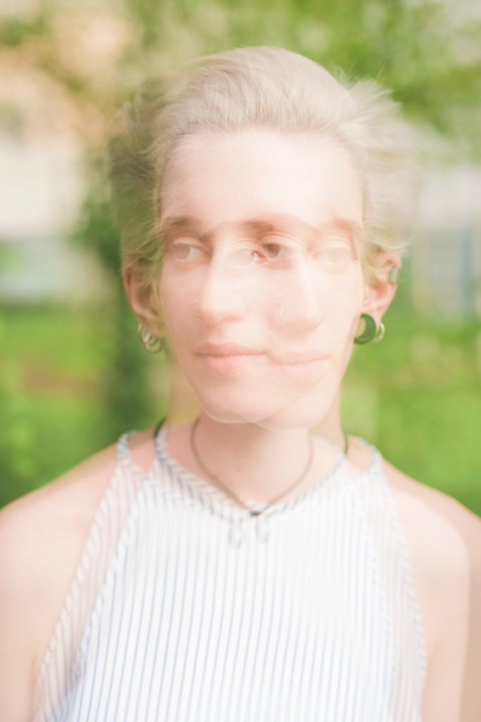Diplopia: Double vision that requires medical attention - NeuroAiD™