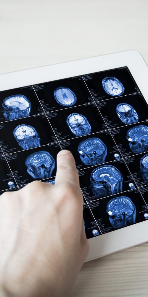 hands hold mri scan of head neck and brain of pat 2021 08 29 11 13 57 utc min