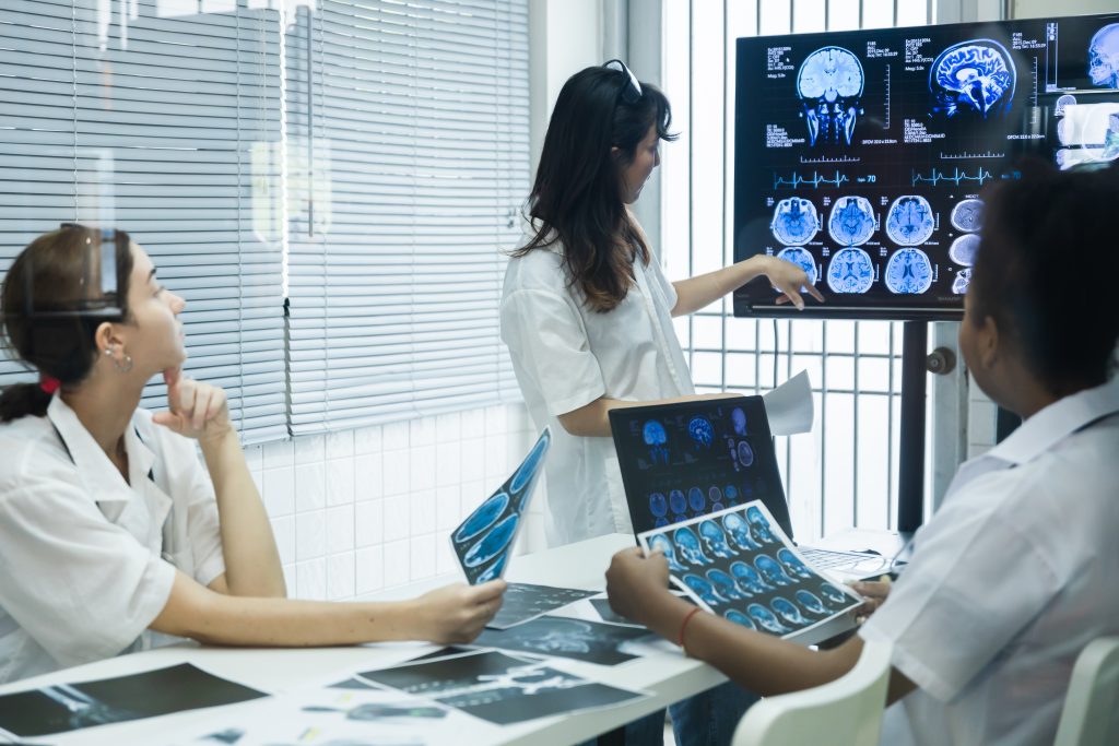 cerebral hypoperfusion and ischemia