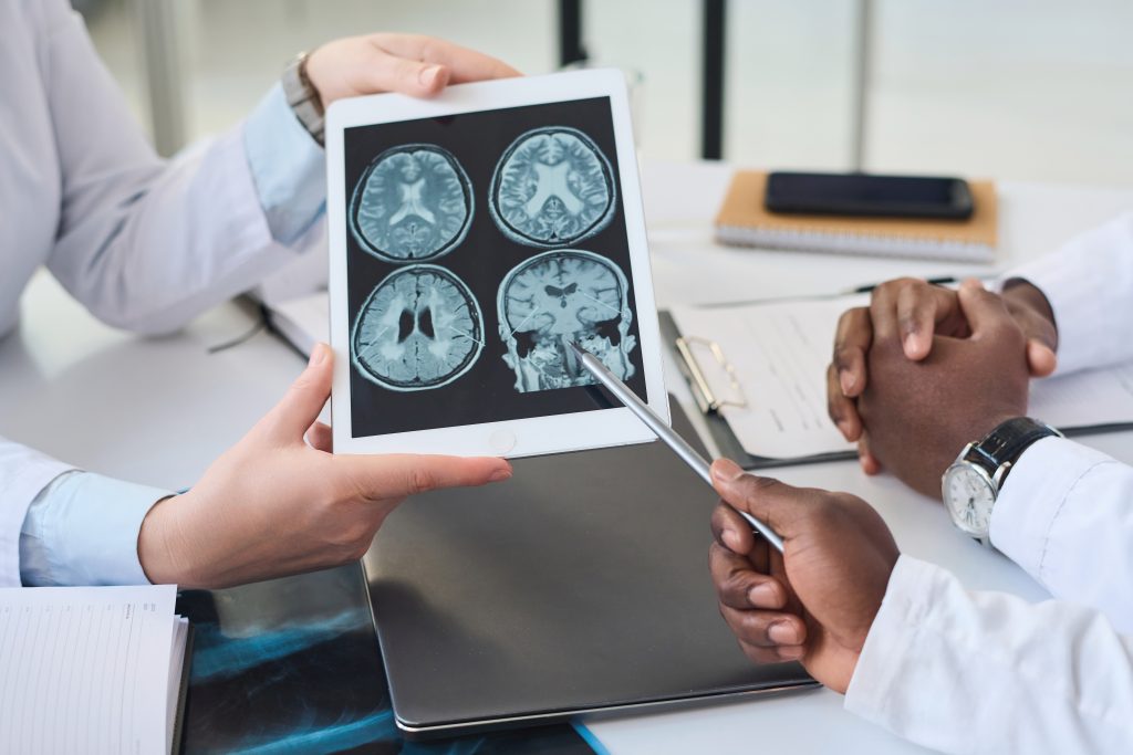 infarto cerebral extenso
