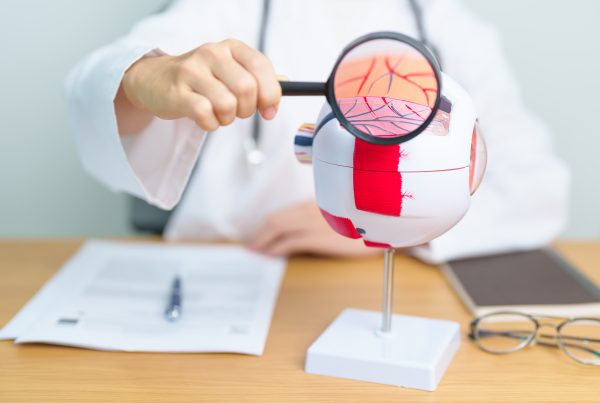infarto de la arteria cerebral anterior