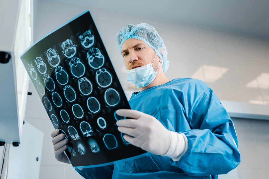 infarto de la arteria cerebral media
