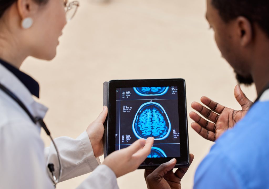 infarto de la arteria cerebral media