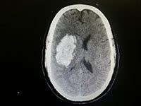 rohanmullinbrainmriscan