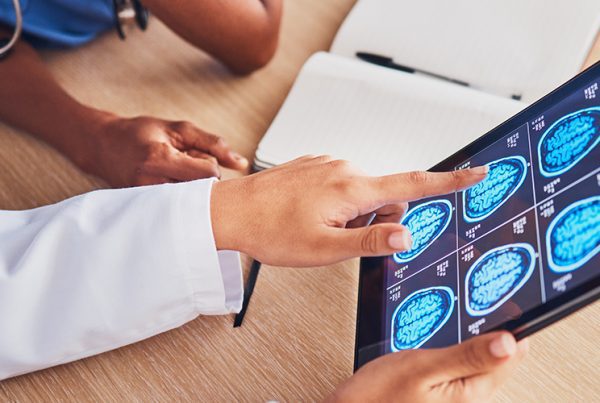 strokenews aug banner