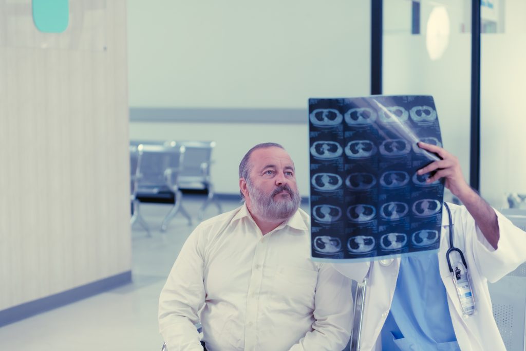 Global aphasia. Characteristics 6 global aphasia