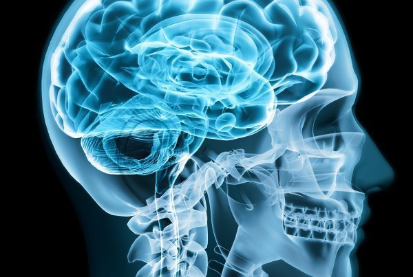 Lesión de la barrera hematoencefálica: implicaciones y manejo en ACV 4 blood-brain barrier