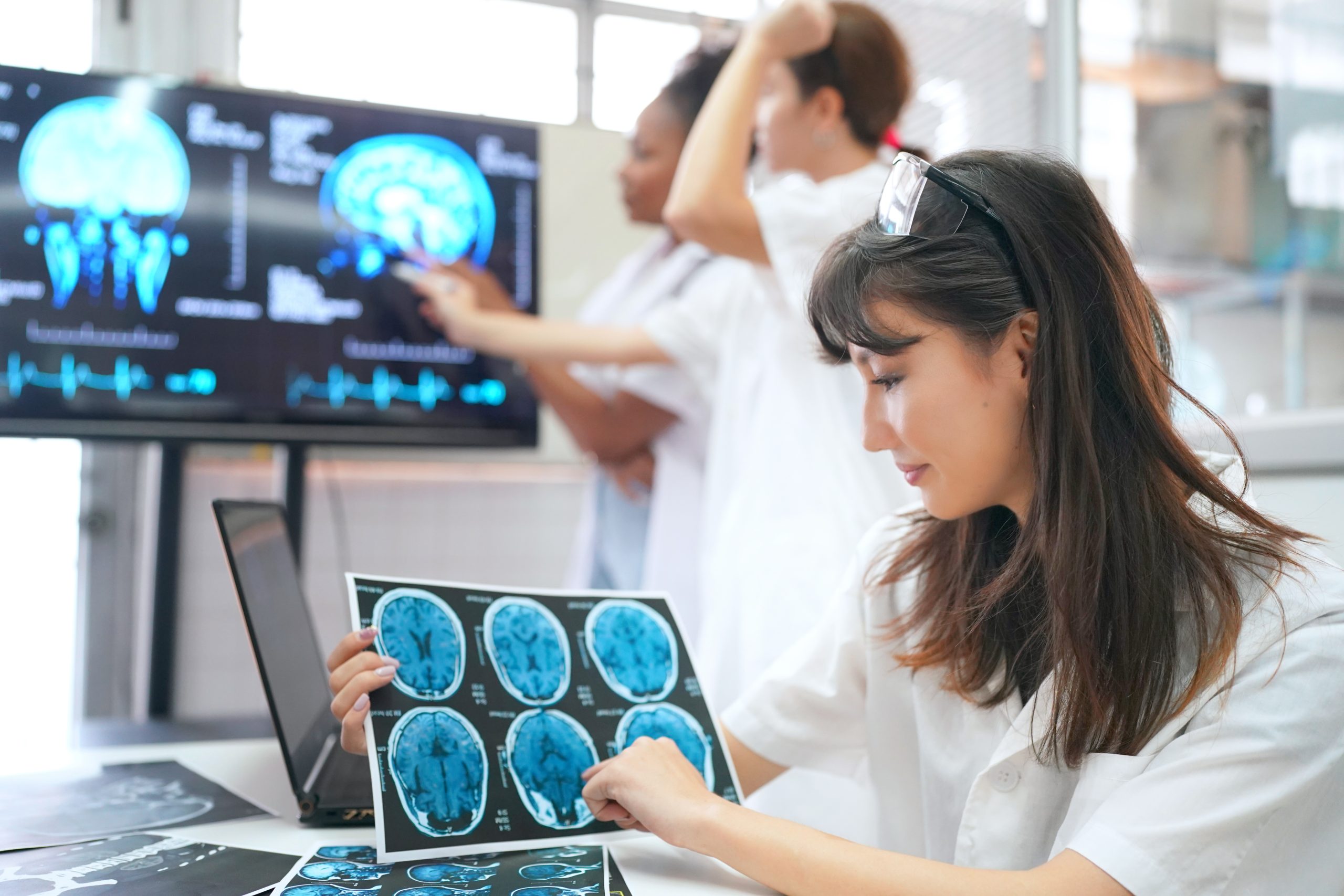 Tonic-Clonic Seizures